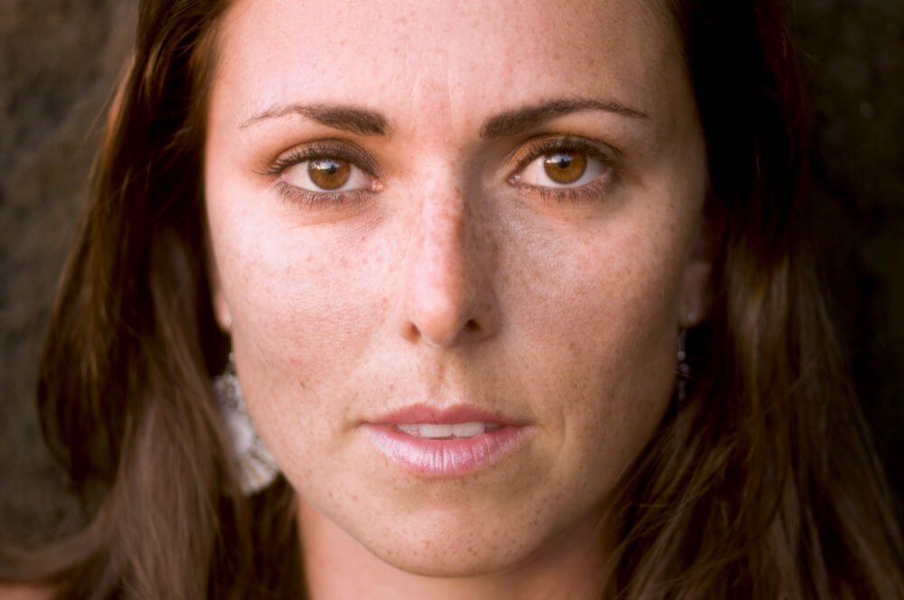 Portrait of woman with slight symptoms of hyperpigmentation