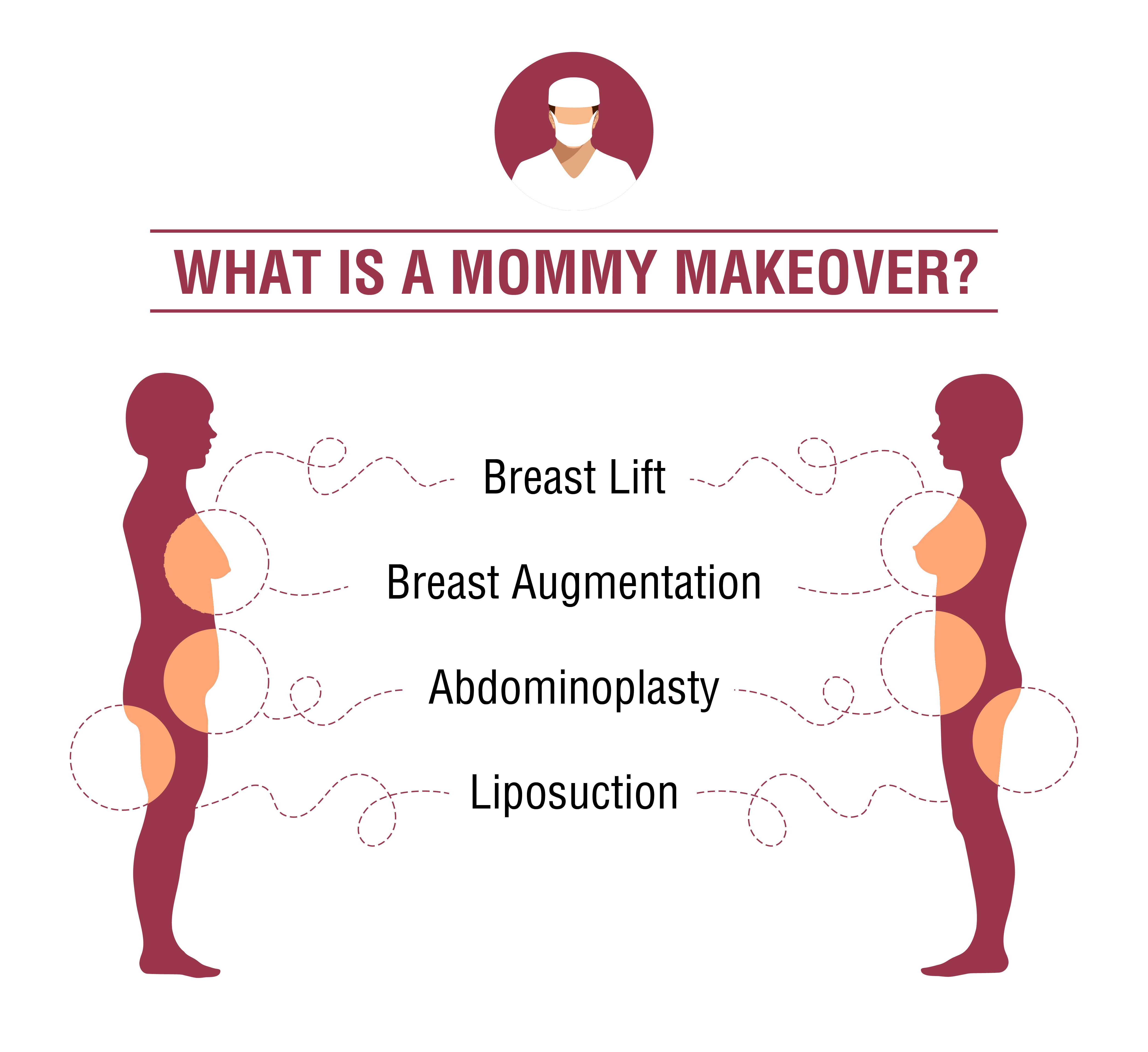 Mommy makeover infographic 