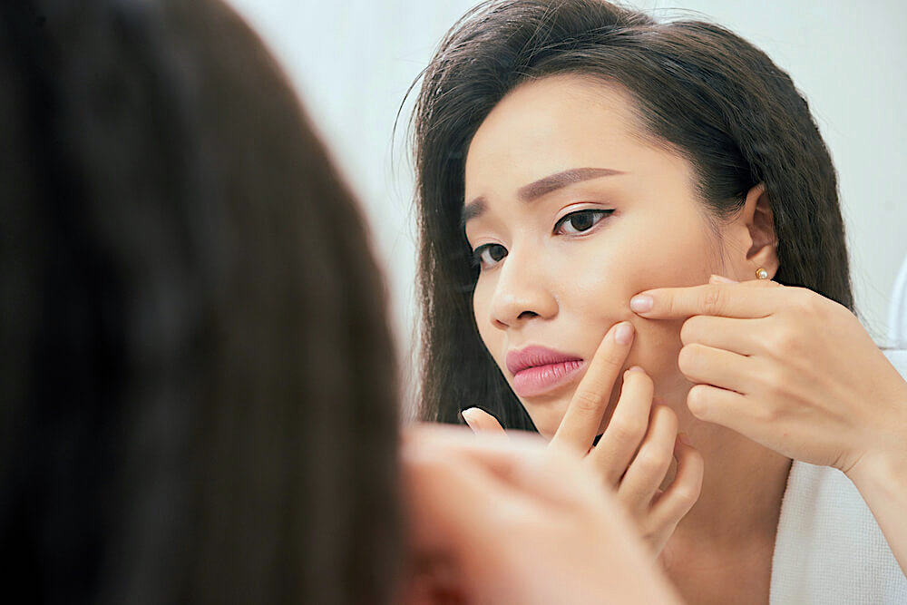 Woman picking on a pimple