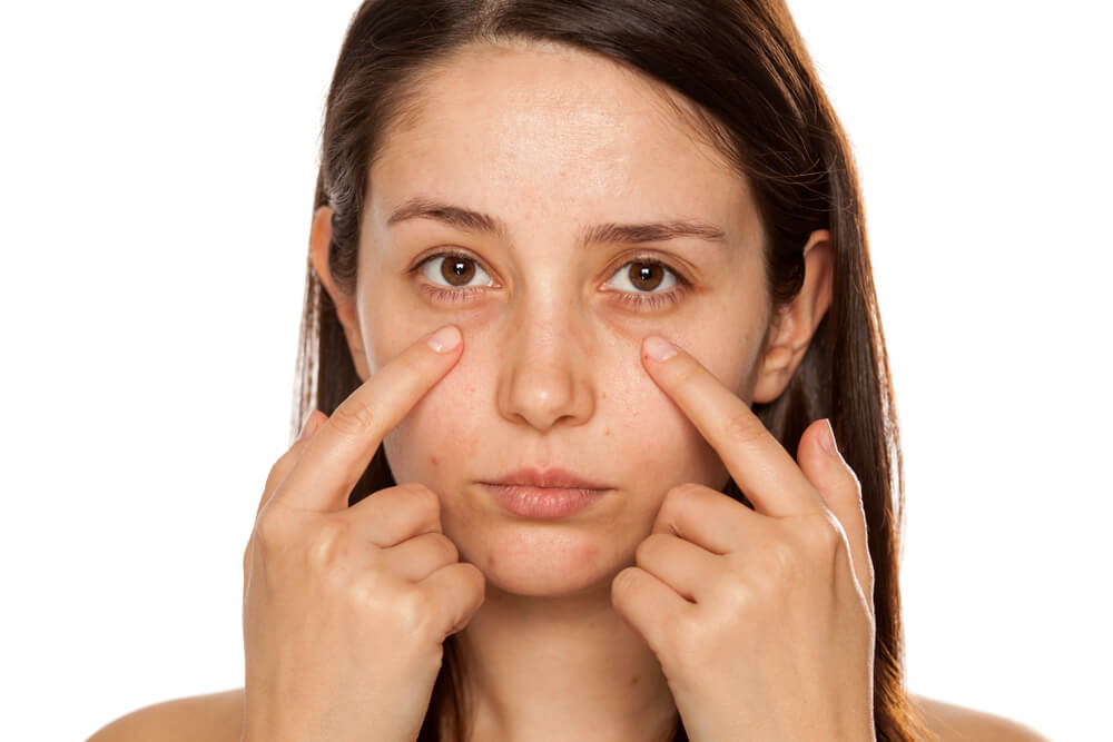 woman with dark circles